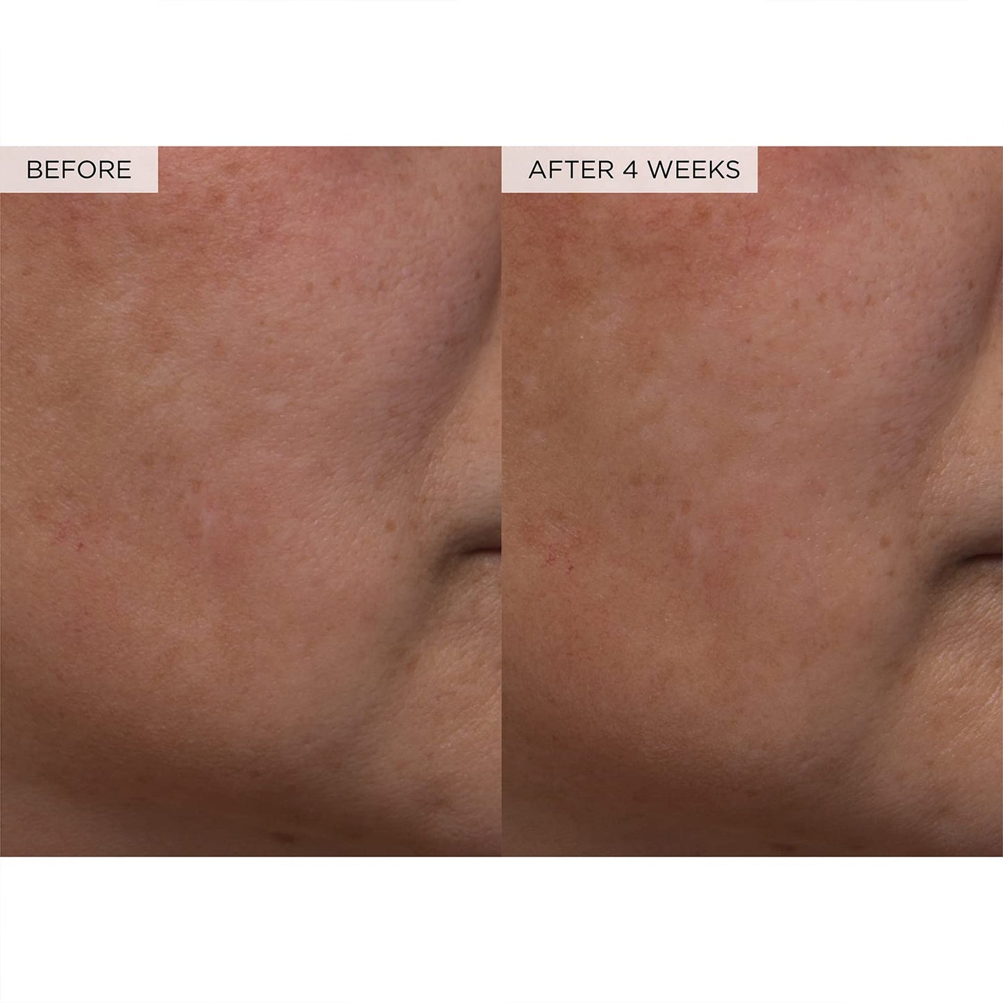 Trevanor Watermelon Glow PHA + BHA Toner
