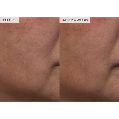 Trevanor Watermelon Glow PHA + BHA Toner